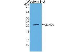 Western blot analysis of the recombinant protein. (FGF21 抗体  (AA 29-209))