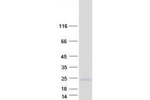 Western Blotting (WB) image for Small Cell Adhesion Glycoprotein (SMAGP) (Transcript Variant 2) protein (Myc-DYKDDDDK Tag) (ABIN2732226)
