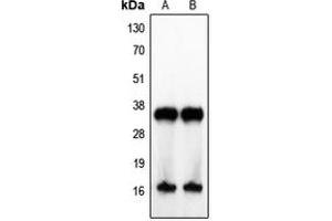 Western blot analysis of IL-4 expression in Jurkat (A), human tonsil (B) whole cell lysates. (IL-4 抗体  (Center))