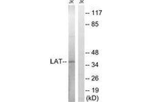 Western blot analysis of extracts from Jurkat cells, using LAT (Ab-161) Antibody. (LAT 抗体  (AA 86-135))
