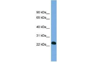 WB Suggested Anti-BCL7A Antibody Titration: 0. (BCL7A 抗体  (Middle Region))