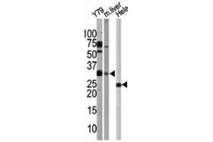 Western Blotting (WB) image for anti-ATG5 Autophagy Related 5 (ATG5) antibody (ABIN2999976) (ATG5 抗体)