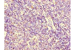 Immunohistochemistry of paraffin-embedded human lymph node tissue using ABIN7156118 at dilution of 1:100 (KPNA2 抗体  (AA 2-285))