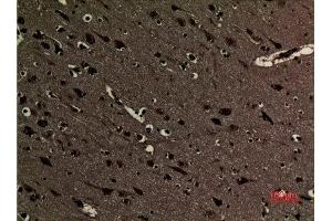 Immunohistochemistry (IHC) analysis of paraffin-embedded Human Brain, antibody was diluted at 1:100. (Histone 3 抗体  (2meLys5))