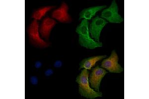 ABIN6258198 and ABIN6276024 staining Hela cells by IF/ICC.