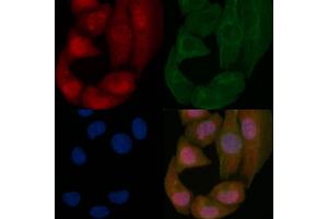 p53 Mouse Monoclonal Antibody staining Hela cells by IF/ICC. (p53 抗体  (Internal Region))