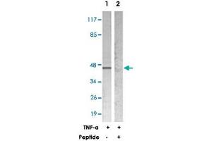 Western blot analysis of extracts from HeLa cells treated with TNF-a (20 ng/mL 5 min), using NFKBIE polyclonal antibody . (NFKBIE 抗体)