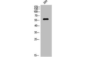 Western Blot analysis of 293 cells using Phospho-PAKγ (S20) Polyclonal Antibody (PAK2 抗体  (pSer20))