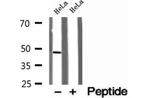 Western blot analysis of extracts of HeLa cells, using RNH1 antibody. (RNH1 抗体  (Internal Region))