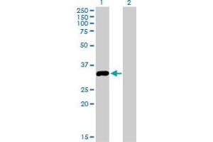 Western Blot analysis of STK16 expression in transfected 293T cell line by STK16 monoclonal antibody (M03), clone 2G6. (STK16 抗体  (AA 1-100))