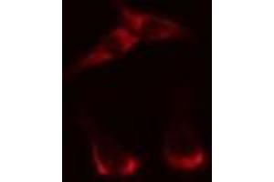 ABIN6269295 staining HepG2? (14-3-3 zeta 抗体  (Internal Region))