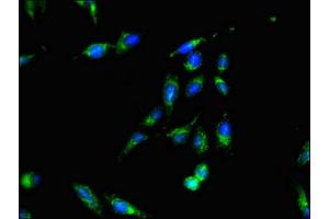 Immunofluorescent analysis of Hela cells using ABIN7170549 at dilution of 1:100 and Alexa Fluor 488-congugated AffiniPure Goat Anti-Rabbit IgG(H+L) (SMS 抗体  (AA 16-191))