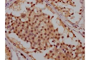 IHC image of ABIN7127351 diluted at 1:100 and staining in paraffin-embedded human testis tissue performed on a Leica BondTM system. (Recombinant ATM 抗体)