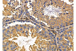 ABIN6263967 and ABIN6276401 at 1/100 staining Mouse testis tissue by IHC-P.