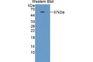 Western blot analysis of the recombinant protein. (NUAK1 抗体  (AA 404-651))