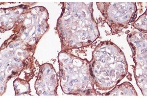 Immunohistochemistry of paraffin-embedded Human placenta using S100P Polyclonal Antibody at dilution of 1:100 (40x lens). (S100P 抗体)