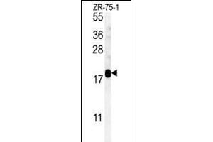 SDHAF1 Antibody (Center) (ABIN651585 and ABIN2840312) western blot analysis in ZR-75-1 cell line lysates (35 μg/lane). (SDHAF1 抗体  (AA 34-62))