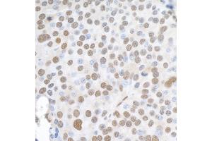 Immunohistochemistry (IHC) image for anti-Heterogeneous Nuclear Ribonucleoprotein K (HNRNPK) (C-Term) antibody (ABIN7454660) (HNRNPK 抗体  (C-Term))