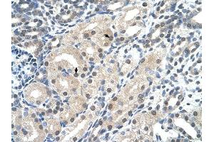 C14ORF130 antibody was used for immunohistochemistry at a concentration of 4-8 ug/ml to stain Epithelial cells of renal tubule (arrows) in Human Kidney. (UBR7 抗体  (C-Term))