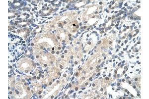 C14ORF130 antibody was used for immunohistochemistry at a concentration of 4-8 ug/ml to stain Epithelial cells of renal tubule (arrows) in Human Kidney.