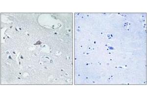 Immunohistochemistry (IHC) image for anti-Opioid Receptor, mu 1 (OPRM1) (AA 21-70) antibody (ABIN2890957) (Mu Opioid Receptor 1 抗体  (AA 21-70))