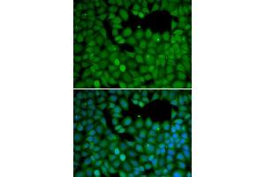Immunofluorescence (IF) image for anti-Neuroepithelial Cell Transforming 1 (NET1) (AA 1-300) antibody (ABIN1513253) (NET1 抗体  (AA 1-300))