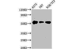 Western Blotting (WB) image for anti-serine/threonine Kinase 3 (STK3) (AA 323-450) antibody (ABIN7168990)