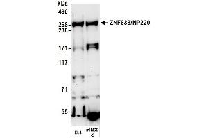 anti-Zinc Finger Protein 638 (ZNF638) (AA 1928-1978) antibody