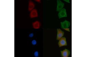 ABIN6258141 and ABIN6275933 staining Hela cells by IF/ICC. (S1PR2 抗体  (Internal Region))