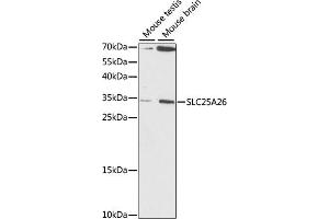 Western blot analysis of extracts of various cell lines, using SLC25 antibody (ABIN7270437) at 1:1000 dilution. (SLC25A26 抗体  (AA 105-185))