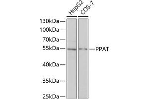 Western blot analysis of extracts of various cell lines, using PPAT antibody (ABIN6128488, ABIN6146009, ABIN6146010 and ABIN6222409) at 1:1000 dilution. (PPAT 抗体  (AA 1-280))