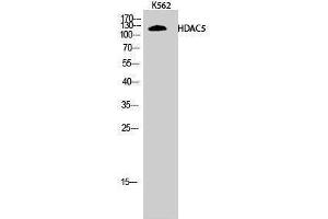Western Blotting (WB) image for anti-Histone Deacetylase 5 (HDAC5) (Tyr512) antibody (ABIN3184988)