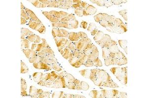 Immunohistochemistry of paraffin embedded mouse skeletal muscle using Sarcomeric α Actinin (ABIN7075510) at dilution of 1:1000 (200x lens) (Sarcomeric alpha Actinin 抗体)