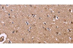 Immunohistochemistry of paraffin-embedded Human brain tissue using S100A13 Polyclonal Antibody at dilution 1:40
