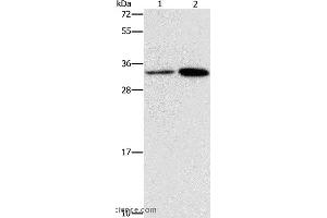 Western blot analysis of Hela and A431 cell, using CDC34 Polyclonal Antibody at dilution of 1:900 (CDC34 抗体)