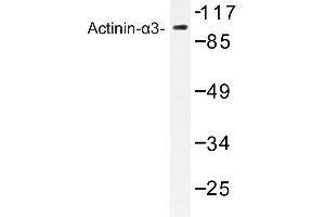 Image no. 1 for anti-Actinin, alpha 3 (ACTN3) antibody (ABIN272284) (ACTN3 抗体)