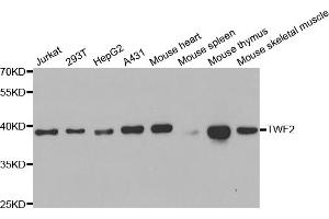 Western blot analysis of extracts of various cell lines, using TWF2 antibody. (TWF2 抗体)