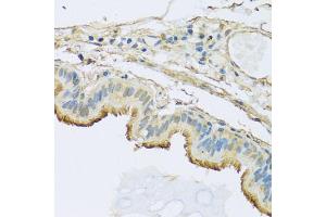 Immunohistochemistry of paraffin-embedded human trachea using NDUFB5 antibody. (NDUFB5 抗体)