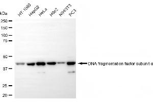 Western blotting analysis using DNA fragmentation factor subunit alpha antibody (ABIN7798363).