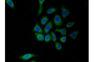 Detection of MAOA in Human HepG2 cell using Polyclonal Antibody to Monoamine Oxidase A (MAOA) (Monoamine Oxidase A 抗体  (AA 229-428))