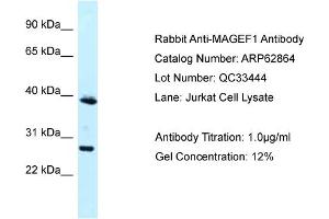 Western Blotting (WB) image for anti-Melanoma Antigen Family F, 1 (MAGEF1) (N-Term) antibody (ABIN2789273) (MAGEF1 抗体  (N-Term))