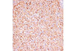 Immunohistochemistry (IHC) image for anti-ATP Synthase, H+ Transporting, Mitochondrial F1 Complex, gamma Polypeptide 1 (ATP5C1) (AA 26-298) antibody (ABIN7265723)