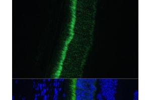 Immunofluorescence analysis of Mouse eye using GNGT1 Polyclonal Antibody at dilution of 1:100 (40x lens). (GNGT1 抗体)