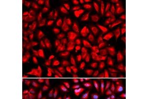 Immunofluorescence analysis of U2OS cells using IPO5 Polyclonal Antibody (Importin 5 抗体)