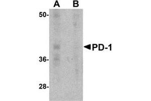 Western Blotting (WB) image for anti-Programmed Cell Death 1 (PDCD1) antibody (ABIN1031789) (PD-1 抗体)
