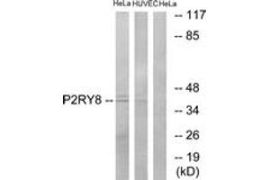Western blot analysis of extracts from HeLa/HuvEc cells, using P2RY8 Antibody. (P2RY8 抗体  (AA 192-241))