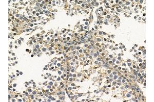 VAPA Mouse Monoclonal Antibody at 1/100 staining mouse testis tissue by IHC-P.