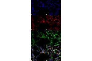 Immunocytochemistry/Immunofluorescence analysis using Mouse Anti-Dityrosine Monoclonal Antibody, Clone 10A6 (ABIN5067469). (Dityrosine 抗体)