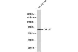 Western blot analysis of extracts of Rat thymus, using CYP3 antibody (ABIN6130166, ABIN6139354, ABIN6139355 and ABIN6223584) at 1:1000 dilution. (CYP3A5 抗体  (AA 233-502))