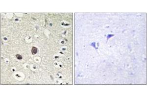 Immunohistochemistry analysis of paraffin-embedded human brain tissue, using TIE2 (Ab-1102) Antibody. (TEK 抗体  (AA 1068-1117))